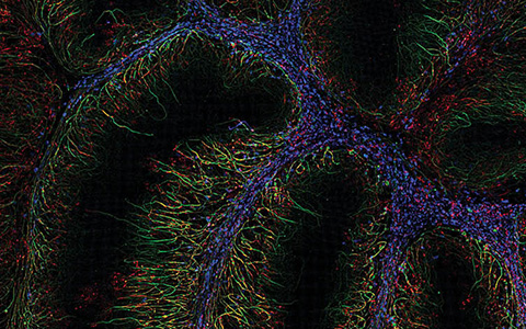 奧林巴斯顯微鏡SEO優化